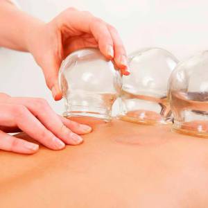 A girl taking cupping therapy at elegance massage